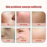 Facial Massager Portable Electric Sonic Rechargeable Cold Ion Skin Care Machine Anti Wrinkle Tightening Devices（DYM-024） - Image 3